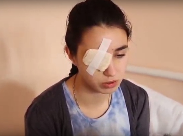 Девушка-волонтер потеряла глаз на квесте. В Рыбинске Ярославской области 17-летняя девушка потеряла